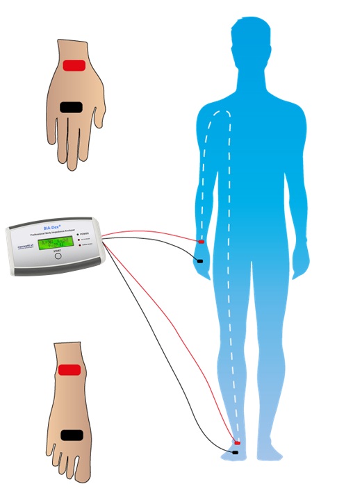 posizionamento elettrodi per la composizione corporea