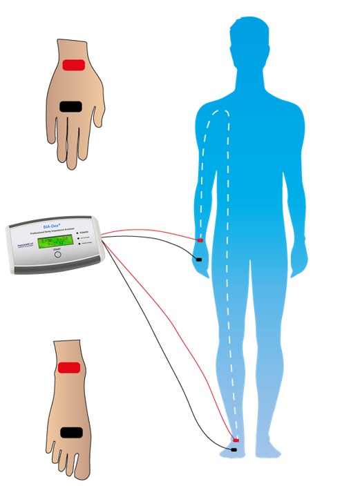 Posizionamento elettrodi Analisi Bia con Bia-dex